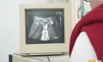 Chồng bị bác sĩ chịch vợ khám phụ khoa qua màn hình siêu âm